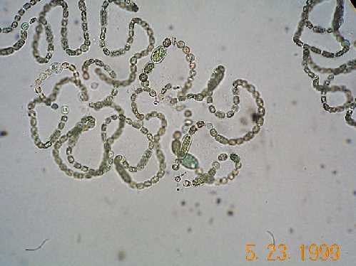 a photo of Anabaena sp. colony