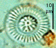 a photo of cyclotella stelligera