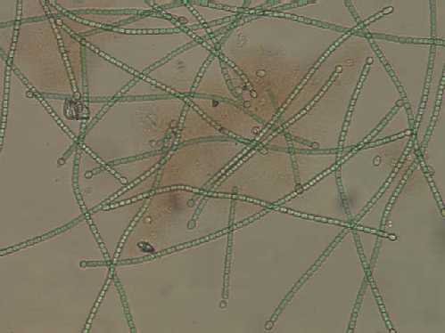 a photo of Cylindrospermum filaments with diatoms intermixed