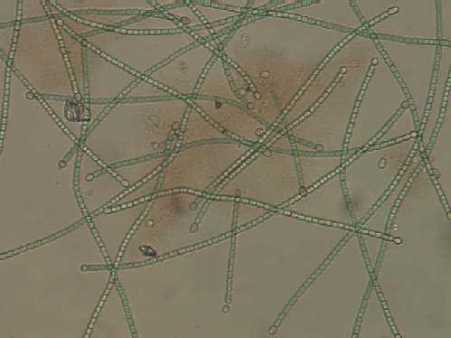 a photo of Cylindrospermum filaments with diatoms intermixed
