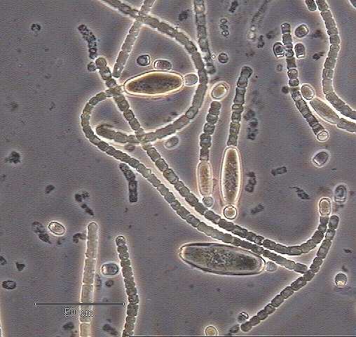 a photo of Cylindrospermum filaments