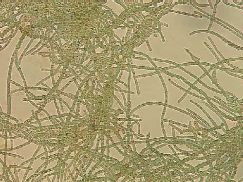 a photo of Fischerella