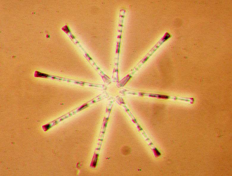 a photo of diatom asterionella formosa