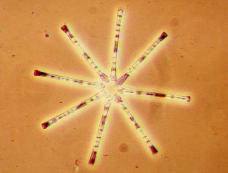 a photo of diatom asterionella formosa