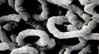 a photo of Nodularia sp.