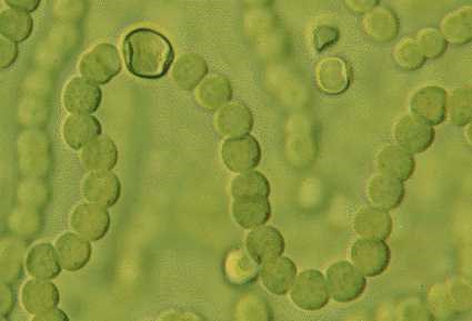 a photo of A closeup of Nostoc sp. filaments