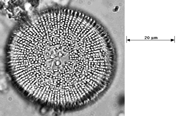 a photo of Orthoseira roseana, valve view