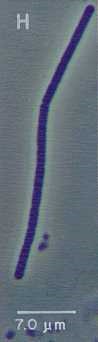 a photo of A microscopic view of Oscillatoria limnetica