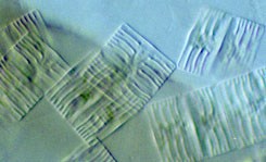 a photo of Tabellaria flocculosa