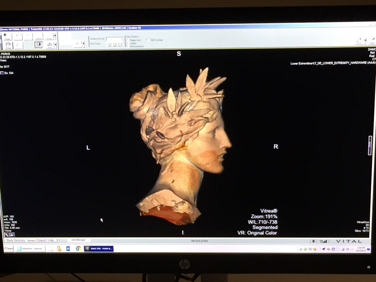 Computer Scan of Woman's Head Sculpture