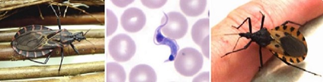 Triatomine bug on finger