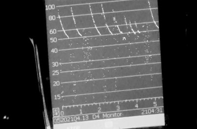 Unsung Heroes of the Night View of bat calls on echo locator device