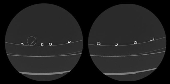 Computed Tomography scanning artifacts