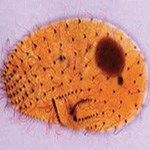 Protozoa