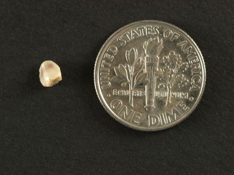 Mystery Tooth Mystery Tooth